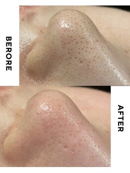 ルアナ(LUANA。)/即効果実感◎男性にも人気です!