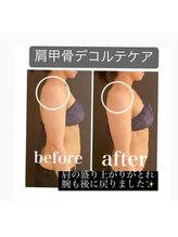 プリオール 太田店(Prior)/肩こり改善ケア