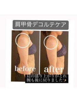 プリオール 太田店(Prior)/肩こり改善ケア