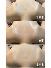 十美/リンパマッサージbefore after