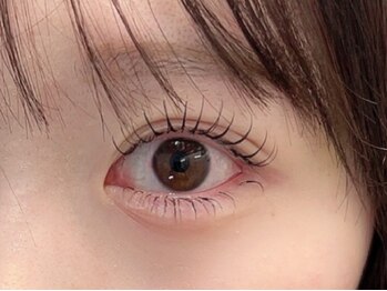 ミニョン(Mignon)の写真/≪逆まつ毛・一重・奥二重の方必見≫豊富なメニューとこだわりの施術で理想の目元を叶える♪モチも抜群◎