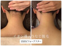 リノ(Lino)/うなじ脱毛シェービング付き♪