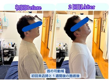 フラット柏(FLAT柏)/首・肩の施術後