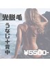 【高速美肌光脱毛】◆◇背中美人(うなじ+ 背中上部)◇◆¥5500