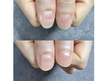 レジューネイル(Rejyu Nail)の雰囲気（深爪改善お悩み爪/噛んでしまう/まずはお越しください）