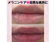 サロンローズ(Salon Rose)