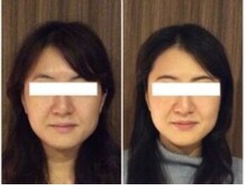 美容整体ウェリナ あま甚目寺院/小顔矯正/骨盤矯正/美脚サロン