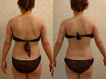 サロン ド 花歩 松山本店/スピード痩身５回の結果！