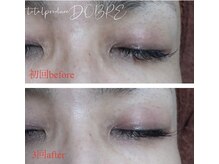 ドブレ(DOBRE)/【目の周りの黒ずみ改善】