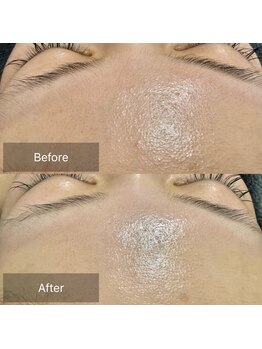 マヴィ(Mavie)/艶肌フェイシャルワックス