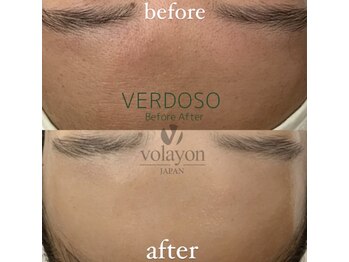 ペイジ(peige)/【peige】症例写真