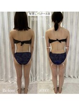 ミミルーチェ(mimiluce)/30分蒸すだけ！ダブル蒸しコース