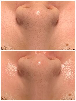 ラグ(LUXU)/美肌菌を入れ込み毛穴レス肌へ◎