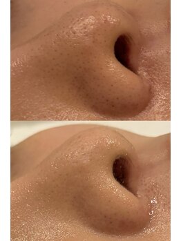 セレニテ(Serenite)/