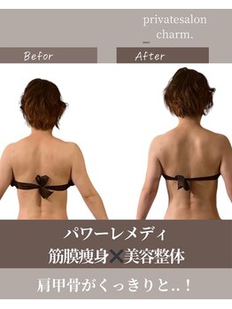 チャーム(charm.)/パワーレメディ筋膜痩身