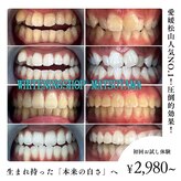 ホワイトニングショップ 松山店