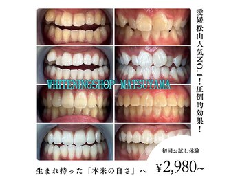 ホワイトニングショップ 松山店