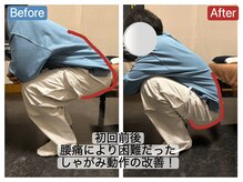 アンティオール 札幌店/30代男性　腰痛/痺れ