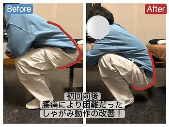 アンティオール 札幌店/30代男性　腰痛/痺れ