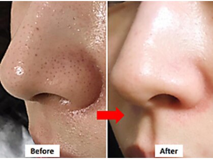 ライム 札幌(LIME)の写真