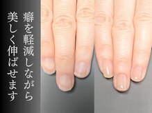 ジップス(zips)の雰囲気（ジェルメニュー全て爪質改善フィルインで爪が美しく変身！）