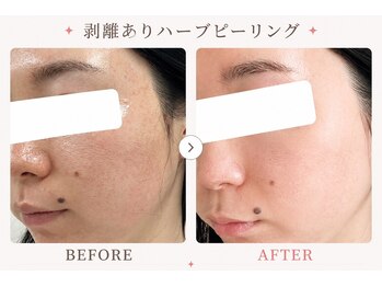 パールプラス 会津若松店/複数回重ねる度に艶肌陶器肌へ
