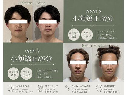 ハイコガオ(HIKOGAO)の写真