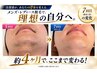 【脱毛】ご新規様クーポンはこちらから↓
