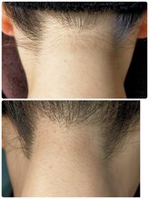 エン(en.)/BeforeAfter写真41