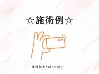 ミリグラム(mg)/【施術例】