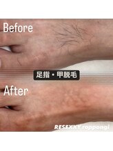 リゼクシー INTERNATIONAL麻布十番 六本木(RESEXXY)/