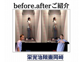 栄光治院 整体院東岡崎/今こそ姿勢美人に！理想の自分に