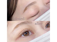 バトン(BATON.)/BEFORE/AFTER