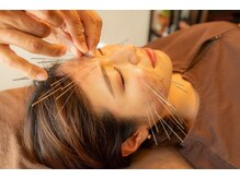 はりひろし鍼灸院/花粉対策