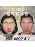 【人気No.1/本格全顔ケア】美容鍼＋小顔矯正＋電気パルサー ¥39,700