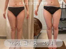 ラシク 吉祥寺(LACHIC)/今年こそスッキリ脚