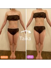タイカ(Taika)/頑固で落ちない下半身太りの方