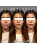 【ブライダル小顔＆姿勢矯正!】 小顔集中改善コースお試し 約75-90分