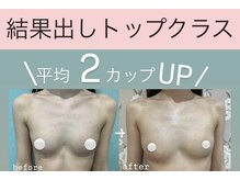 カウンセリングからバストアップニストにお任せ♪元祖脂肪増殖店