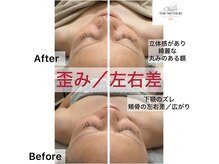 サザンベル 那覇店(Southern Belle)の雰囲気（骨から整え本来の位置にChinoTHEMETHODフェイスメソッド）