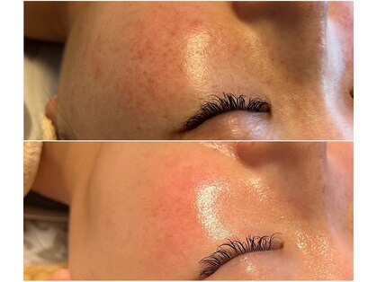 ココビ(COCOVi)の写真