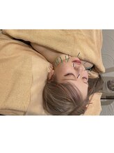 ストリ(STRI)/美容鍼＋頭の鍼