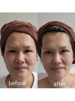 リルーチェ 倉敷(Riluce)/フルオプション1回の施術