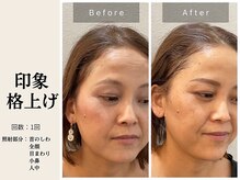 サロン ルイス アディクト(salon Lewis Addict)/ハイアールエフウェーブ