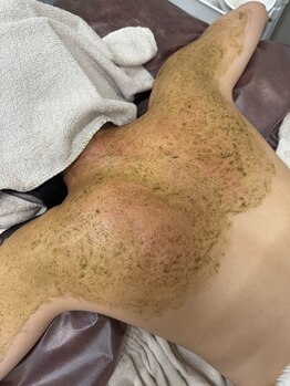 エピュール(Epurer)の写真/大切な日を最高の状態で迎えたいあなたへ。背中ニキビを改善し、自信の持てるドレス姿を叶えましょう◎