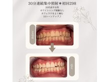 プラスビーセルフ(+b self)/ホワイトニングビフォーアフター