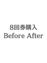 ホワイトニングカフェ 茨木店/