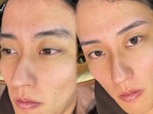 イーラディン(E-RADIN)の雰囲気（その方に合わせた男性に特化した眉毛デザインをご提案☆）