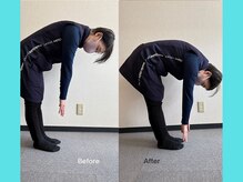 第2まえだ鍼灸整骨院/姿勢調整　M様