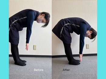 第2まえだ鍼灸整骨院/姿勢調整　M様